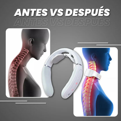 Masajeador Cervicalix Pro 2.0™ + Almohada Quiropráctica + Parches (GRATIS) - Tiendacasa